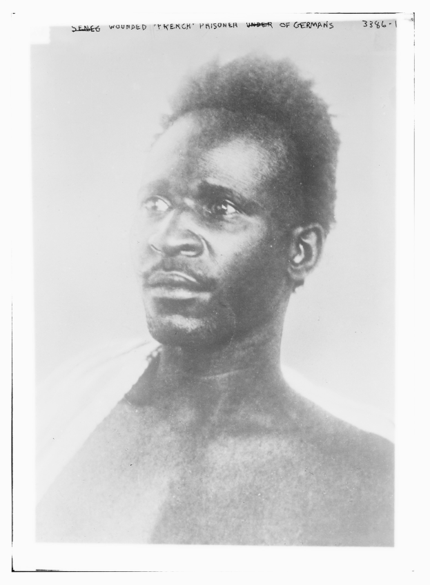 Schwarz-weiß-Foto eines Mannes mit ernstem Gesichtsausdruck, beschriftet mit 'Seneg Verletzter Französcher Kriegsgefangener'.