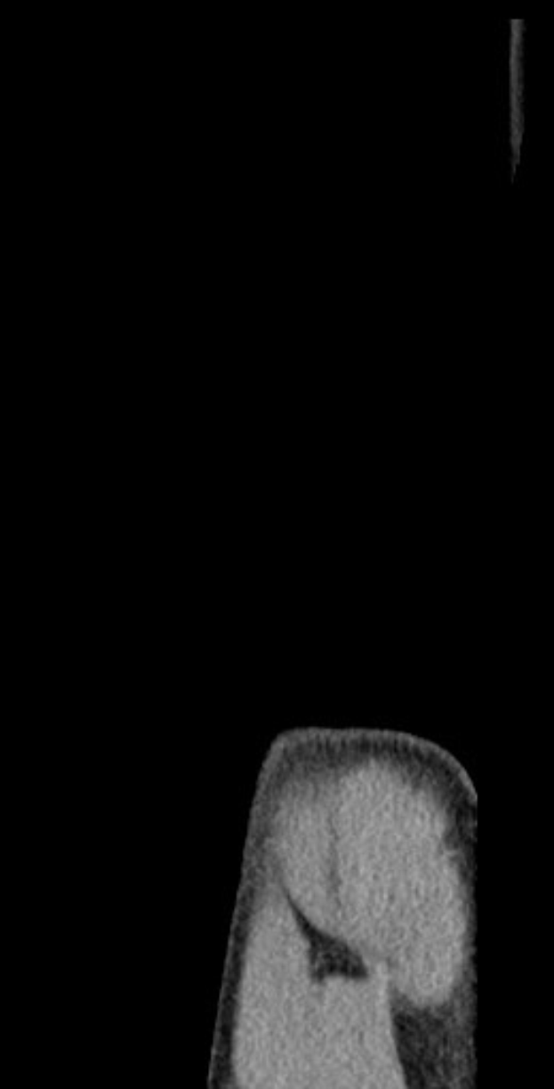 Schwarze und weiße MRI-Aufnahme eines Knies, die detaillierte Innenansichten zeigt.